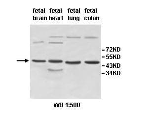 IHC-plus™ Polyclonal Rabbit anti-Human INPP5A Antibody (aa128-330, IHC, WB)