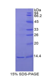 Rat INHBE / Activin Protein (Recombinant His)