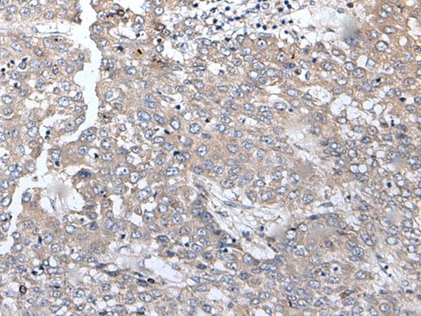 MGC11296 / BRMS1L Antibody