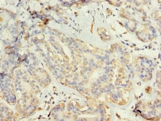 Polyclonal Rabbit anti-Human TUBG2 / Tubulin Gamma 2 Antibody (IHC)