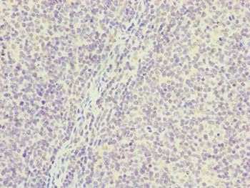 PGLS / 6PGL Antibody