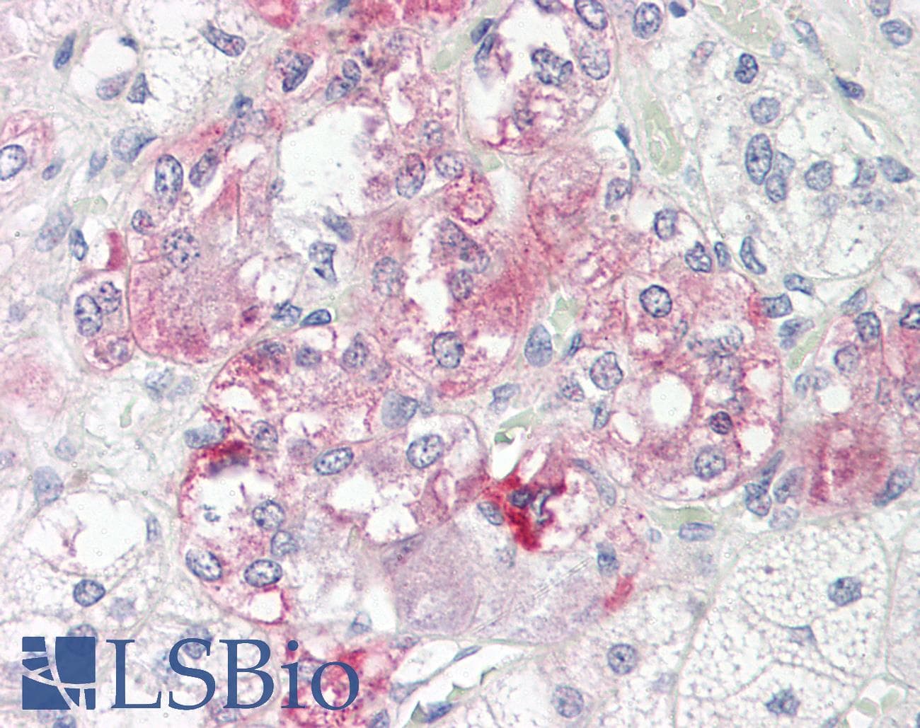 RIP1 / RALBP1 Antibody (N-Terminus)