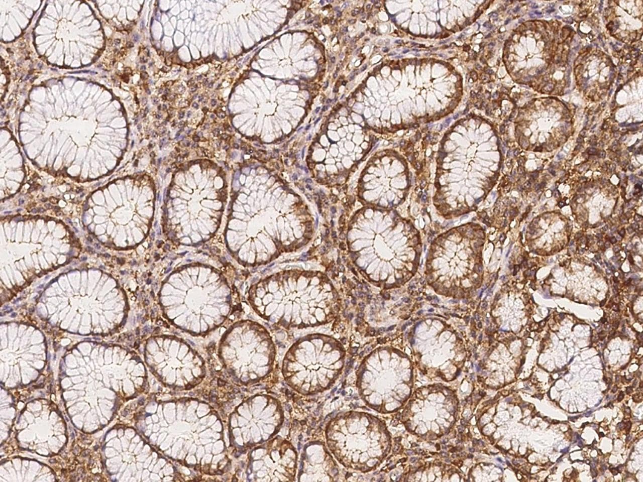 NAV1 Antibody