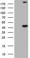 PAICS / ADE2 Antibody (clone OTI2C9)