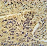 Polyclonal Rabbit anti-Human TAF2 Antibody (aa1152-1180, IHC, WB)