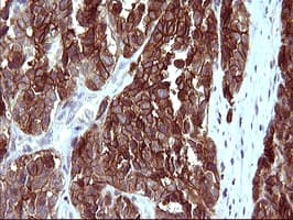EPCAM Antibody (clone OTI1H9)