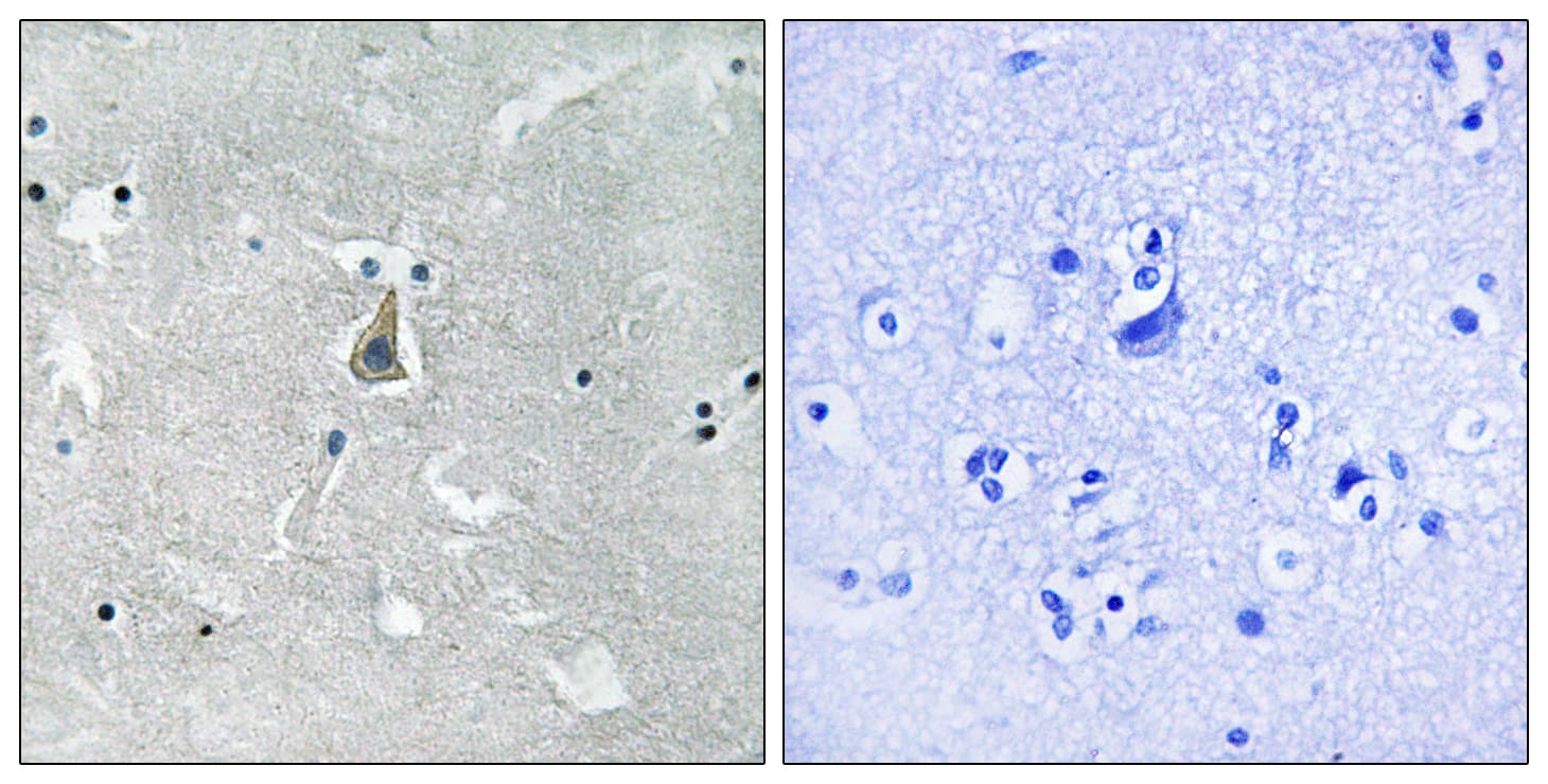 BAX Antibody (phospho-Ser184)
