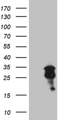 MGMT Antibody (clone OTI6G6)