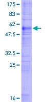 Human FP / PTGFR Protein (Recombinant GST)