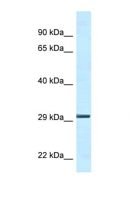 YWHAE / 14-3-3 Epsilon Antibody (C-Terminus)
