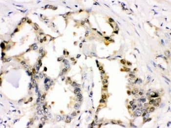 Polyclonal Rabbit anti-Human CDK2 Antibody (IHC, WB)