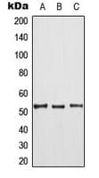 MAP3K8 / TPL2 Antibody (phospho-Thr290)