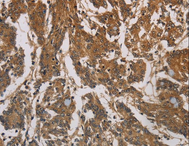 Polyclonal Rabbit anti-Human CORO1C Antibody (IHC, WB)