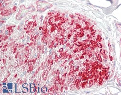 IHC-plus™ MLC2 / MYL9 Antibody (aa3-52)