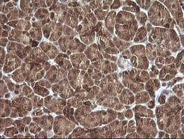 PIK3R5 Antibody (clone OTI5B1)
