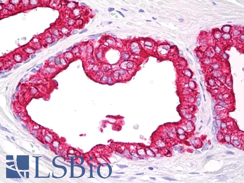 IHC-plus™ Monoclonal Mouse anti-Human Cytokeratin 5+18 Antibody (clone C-50, IHC, WB)