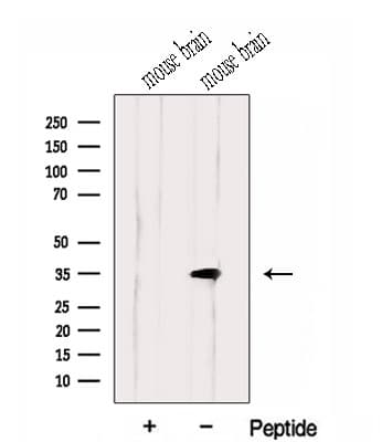 Polyclonal Rabbit anti-Human HMGCL Antibody (WB)
