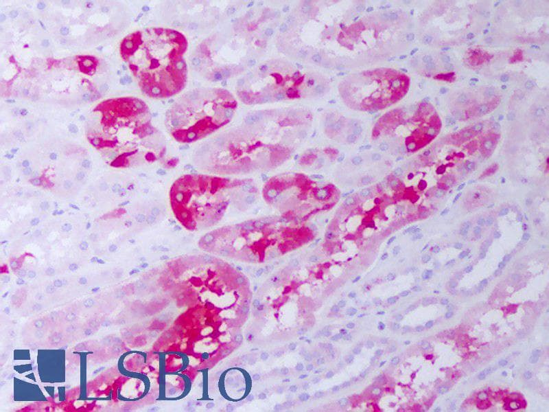 IHC-plus™ CRYAB / Alpha B Crystallin Antibody (clone 1A7.D5)