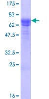 Human SESN3 Protein (Recombinant GST)