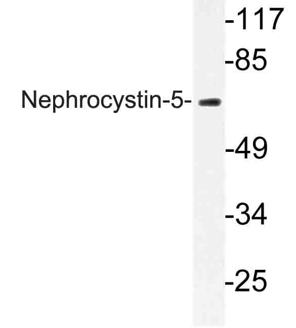IQCB1 Antibody (Arg467)