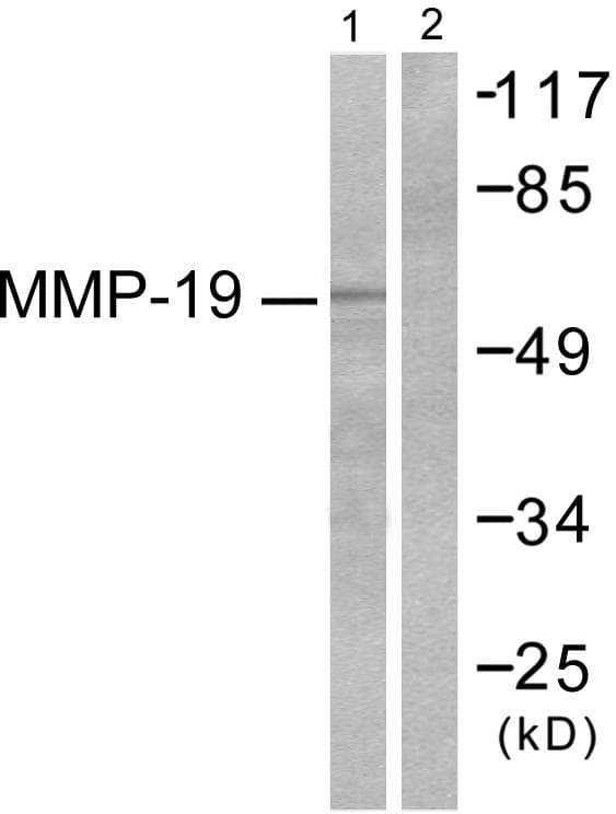 MMP16 Antibody