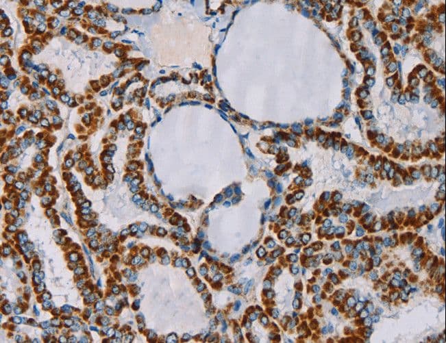 MTCP1NB Antibody