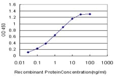 IHC-plus™ Monoclonal Mouse anti-Human DMPK / DM Antibody (clone 2F7, IHC, WB)