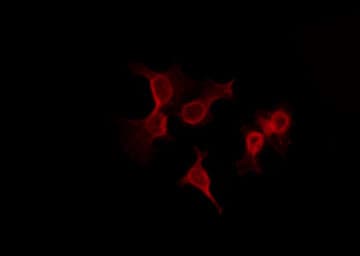 ADNP Antibody