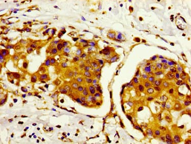 HIST1H2AI Antibody