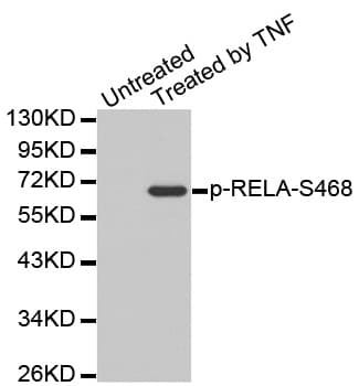 Polyclonal Rabbit anti-Human RELA / NFKB p65 Antibody (phospho-Ser468, WB)