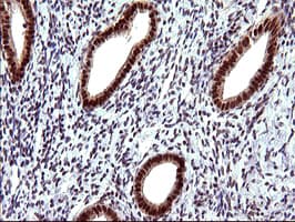 UPRT Antibody (clone OTI1A3)