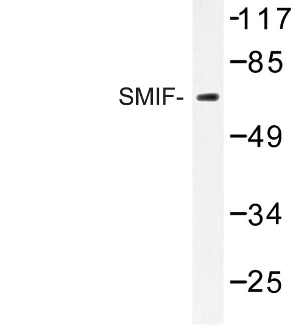SMIF / DCP1A Antibody (Ser133)