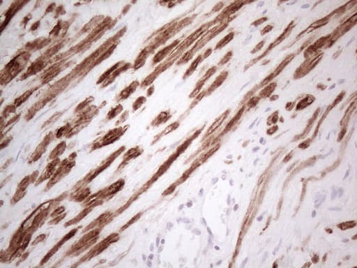 SPATA22 Antibody (clone OTI1E2)