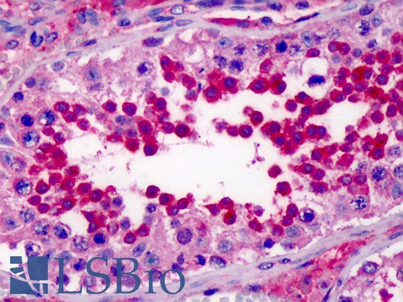 Polyclonal Rabbit anti-Human NUDT9 Antibody (C-Terminus, IHC, WB)