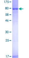 Human SUOX / Sulfite Oxidase Protein (Recombinant GST)