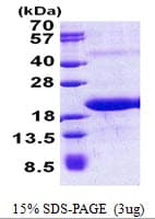 Human MED21 Protein (Recombinant His)
