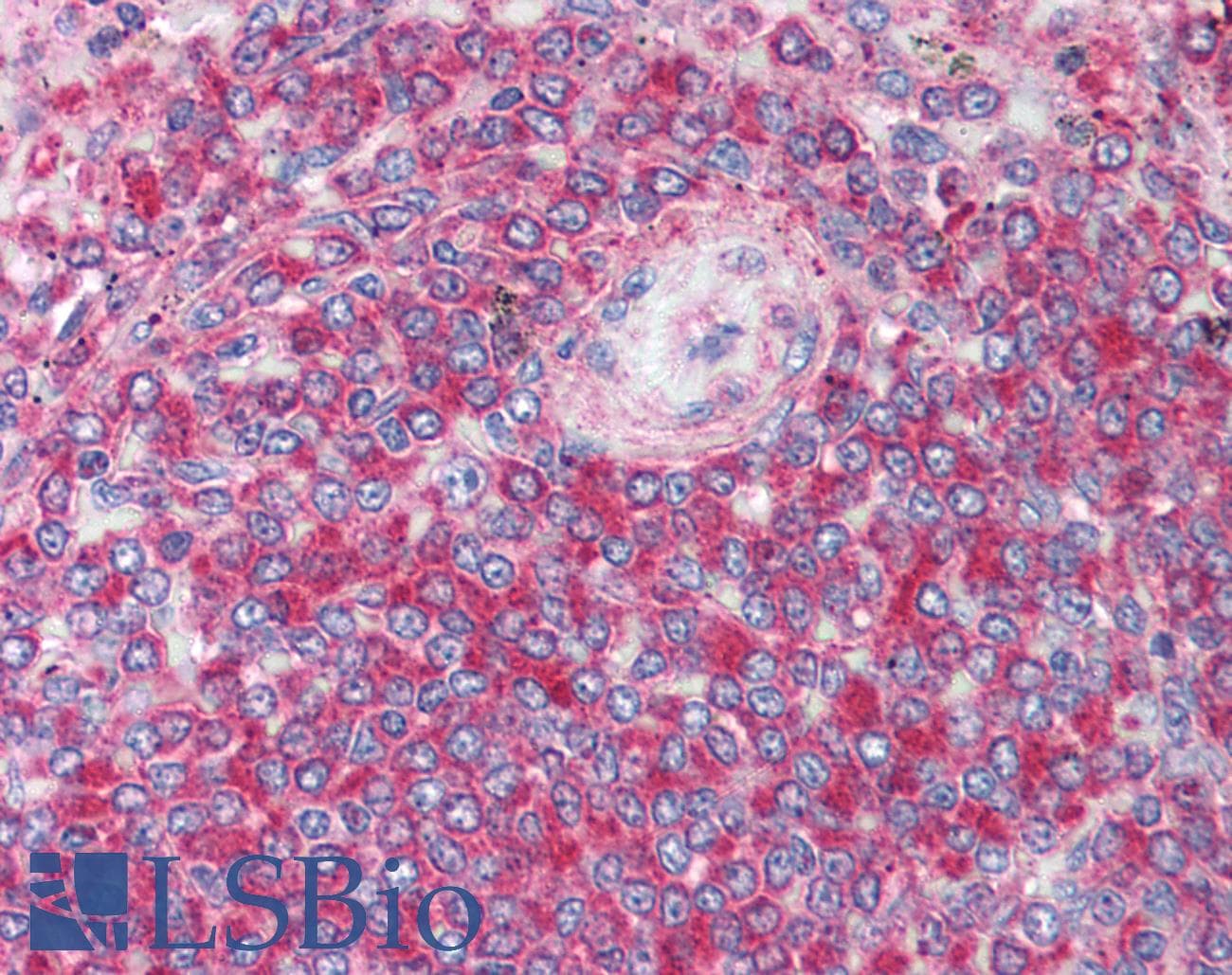 IHC-plus™ XBP1 Antibody