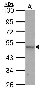 IPMK Antibody (aa26-295)