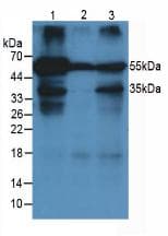 ORM1 / Orosomucoid Antibody (clone C7)
