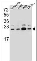 SSR2 Antibody (aa154-183)