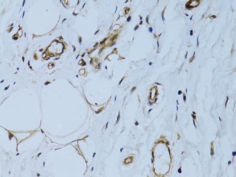 Polyclonal Rabbit anti-Human MCAM / CD146 Antibody (IHC, WB)