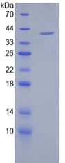 Human Complement C4a Protein (Recombinant His-GST)