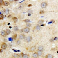 YWHAQ / 14-3-3 Theta Antibody (C-Terminus)