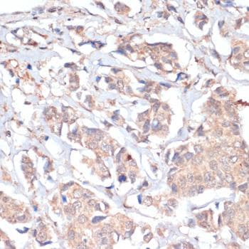 PRMT7 Antibody