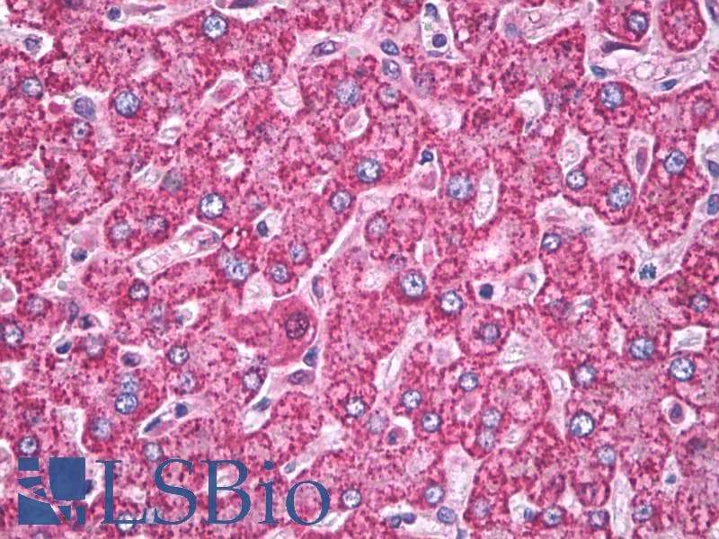 PathPlus™ SOD2 / Mn SOD Antibody