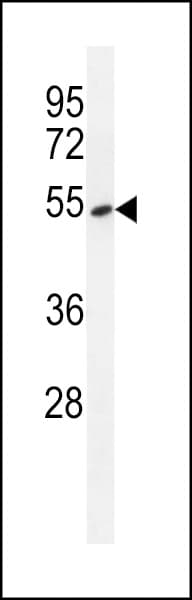 TDP2 / TTRAP Antibody (aa246-272)