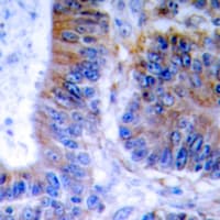 TNFAIP1 Antibody (Internal)