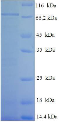Human TEKT5 Protein (Recombinant His-SUMO)