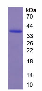 Rat MMP8 Protein (Recombinant His-T7)