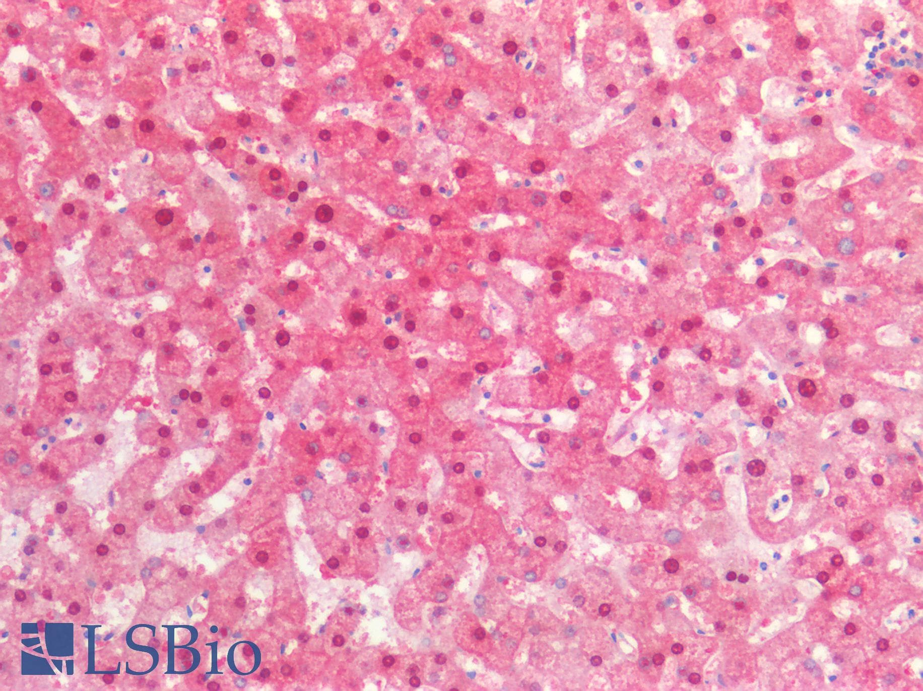 PathPlus™ IDH1 / IDH Antibody (clone AT25H10)